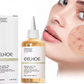 Eelhoe - Glycolic Acid 7% Toning Solution